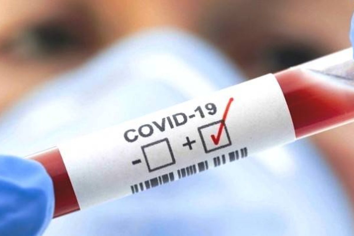 positivo-Covid-19